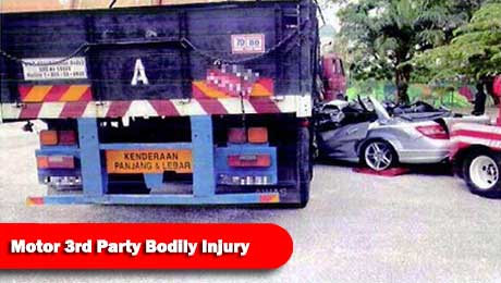 Loss Adjuster Motor Third Party Bodily Injury